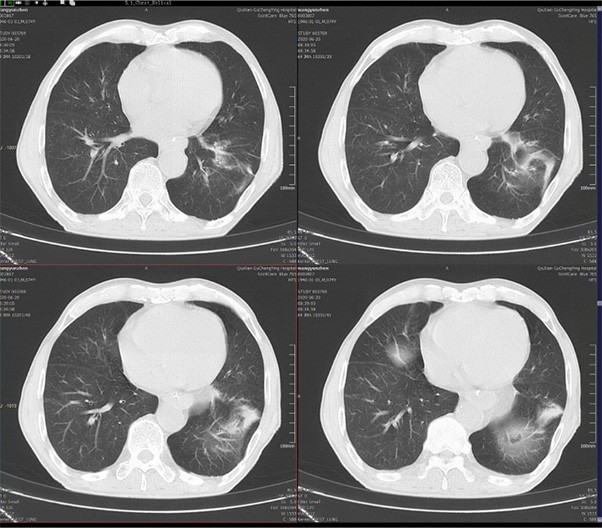 Axial and Helical Scan