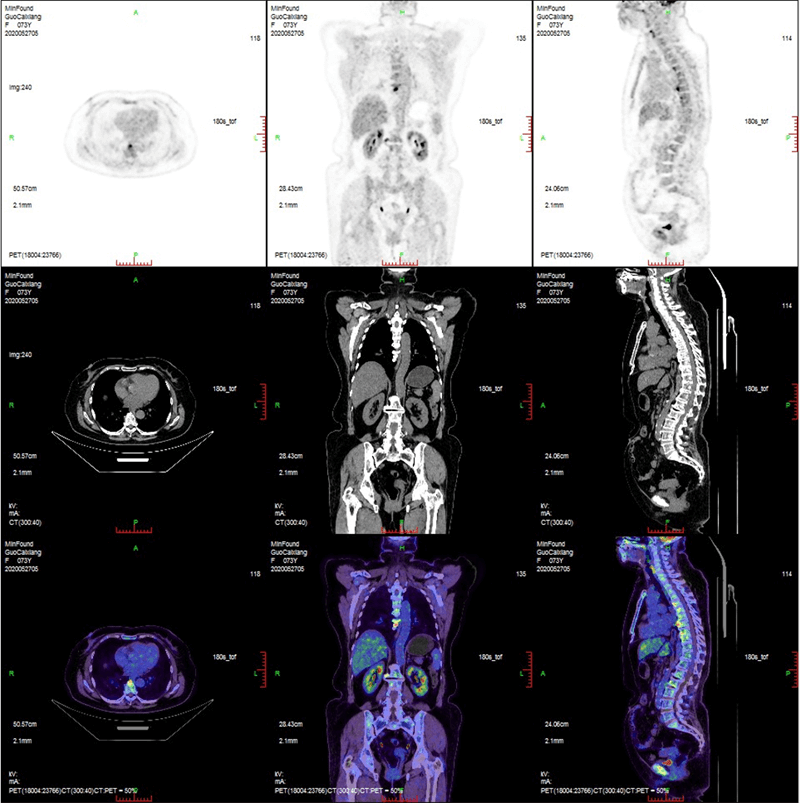 Clinical case 5