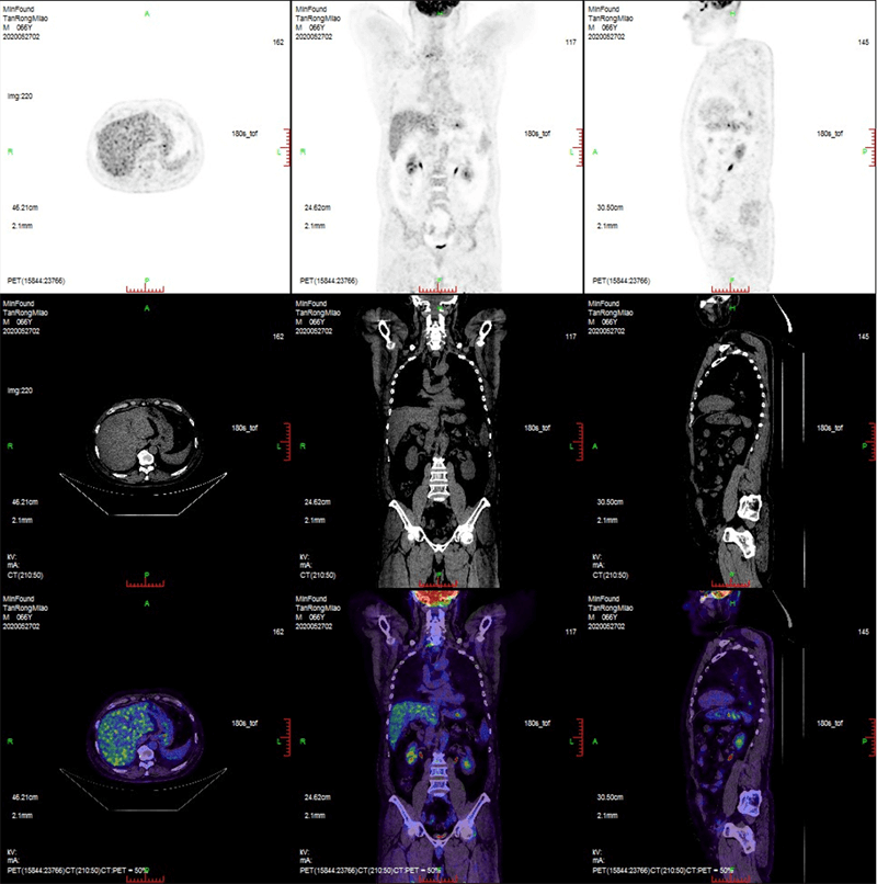 Clinical case 3