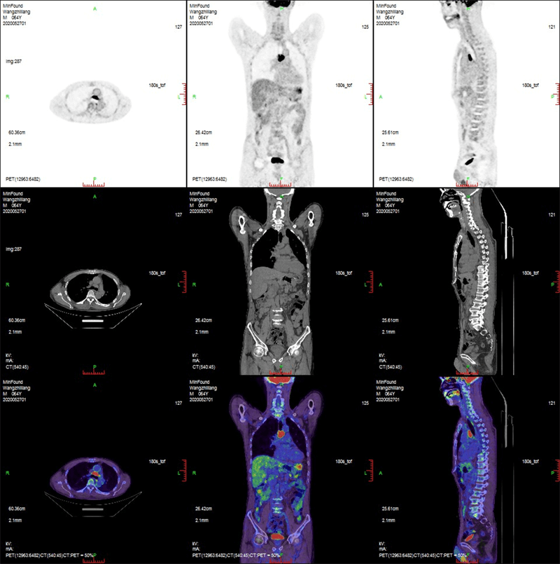 Clinical case 2