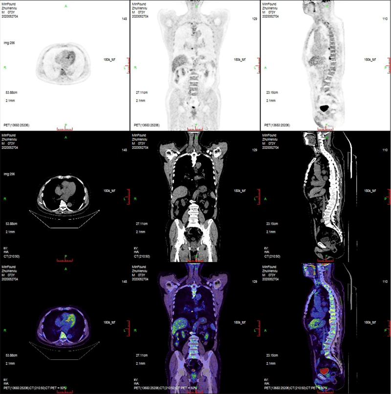 Clinical case 1