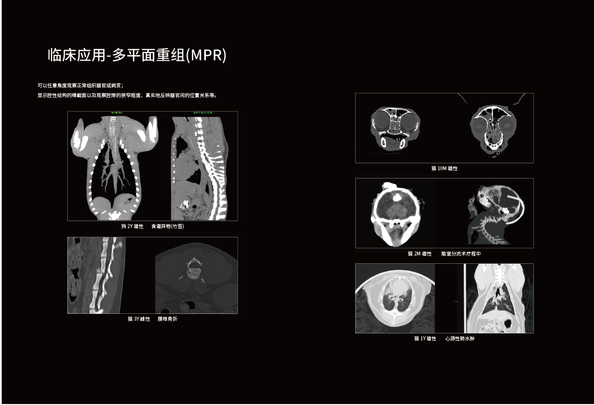 ScintCare V32+系列